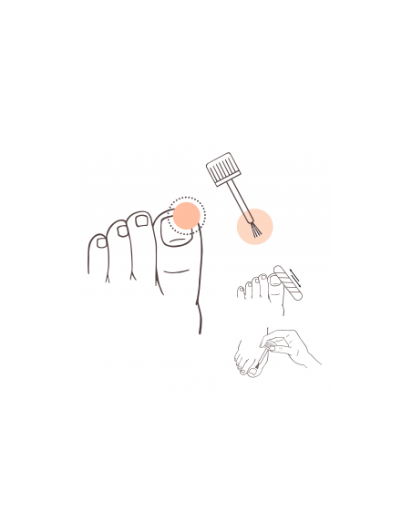 PRANAROM AROMADERM LOCION FONGIAROM UÑAS Y PIEL 10ML